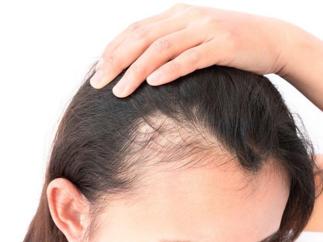 Fighting with Hairfall? Try These 5 Hair Massage Oils To Fight It Better!