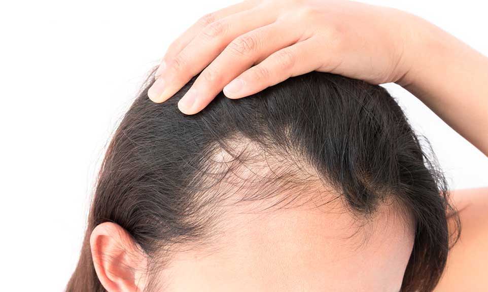 Does Oil Massage Cause Hair Fall?